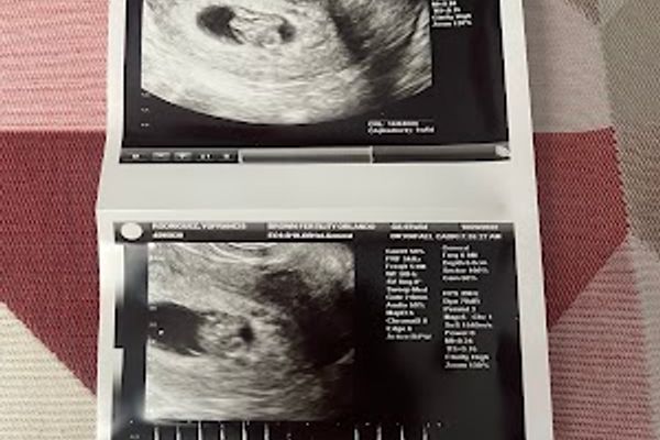 Brown Fertility
