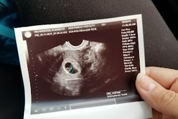 Northwest Fertility Center