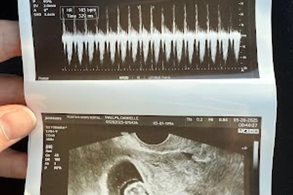 Positive Steps Fertility